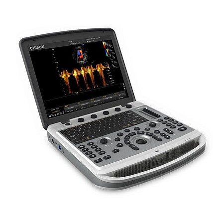 УЗИ аппарат Chison SonoBook 8