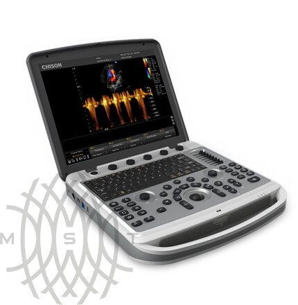 УЗИ аппарат Chison SonoBook 8