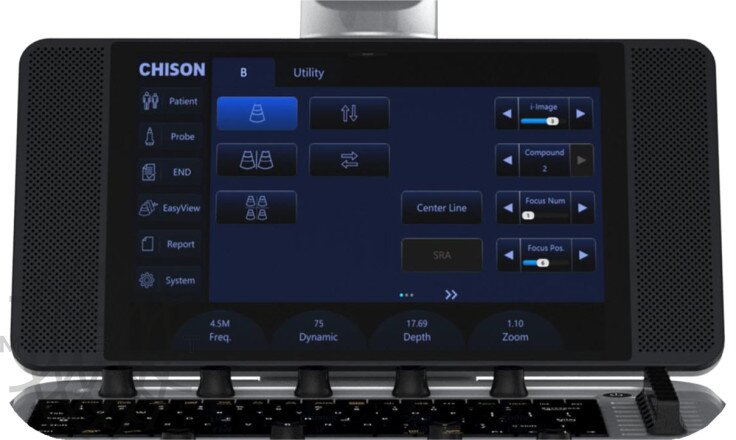 Chison Qbit 6 ультразвуковой аппарат