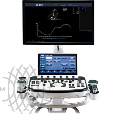 Chison XBit 90 ультразвуковой аппарат