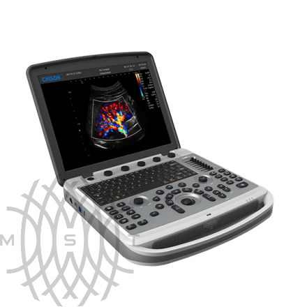 УЗИ аппарат Chison SonoBook 6