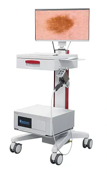 Аппарат для цифровой дерматоскопии FotoFinder vexia