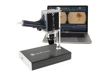 Аппарат для цифровой дерматоскопии FotoFinder medicam 1000 с док-станцией