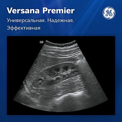 УЗИ аппарат GE Versana Premier Platinum
